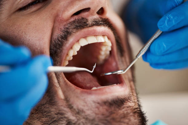 Best Knocked-Out Tooth Emergency  in Bayonet Point, FL